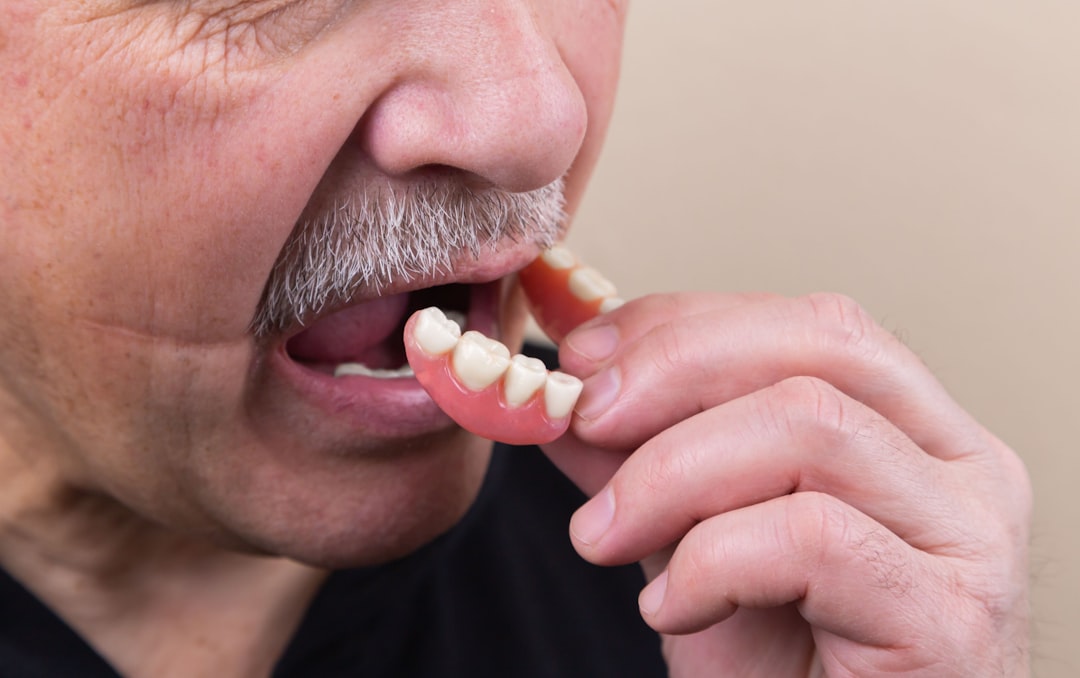 Dental Insurance and Wisdom Teeth Removal: What’s Covered?